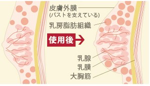 ���傫���Ȃ� �G�X�e�T���� �L���N���j�b�N ���J�j�Y��